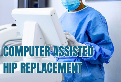 Computer Assisted Hip Replacement surgery by Dr Karthik Gudaru